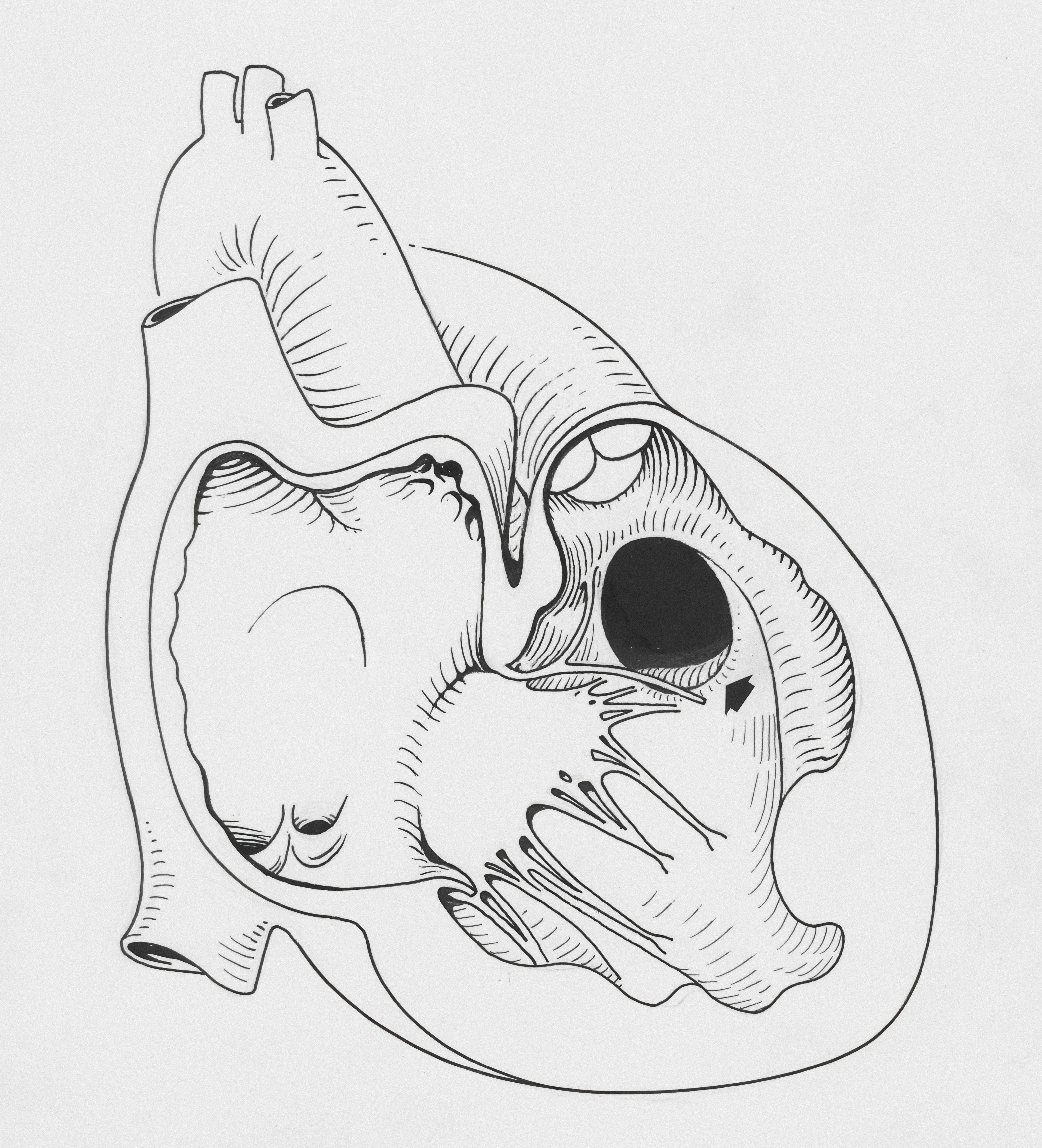 Palpitations : quand faut-il s’inquiéter ?